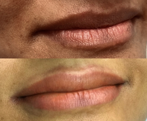 Lip Blushing - Lip Liner | Cosmetic Tattooing Sydney