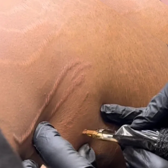 Stretch Mark Camouflage Sydney Brazilian stretch mark camouflage tattooing Sydney